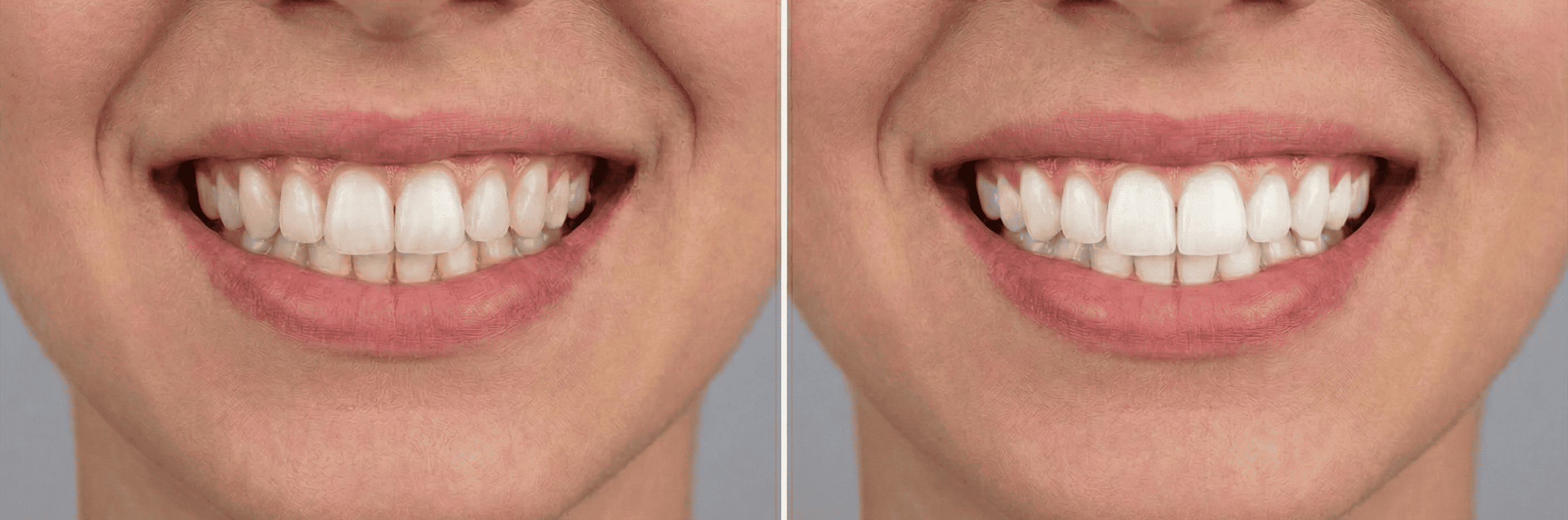 Estética do Sorriso